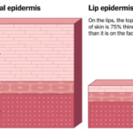 Like Your Epidermis NYT - Epidermis Layers